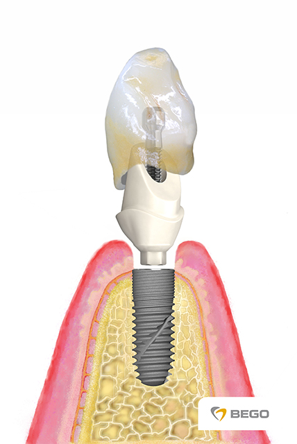 Zahnersatz Praxis Dr. Nicole Fenck
